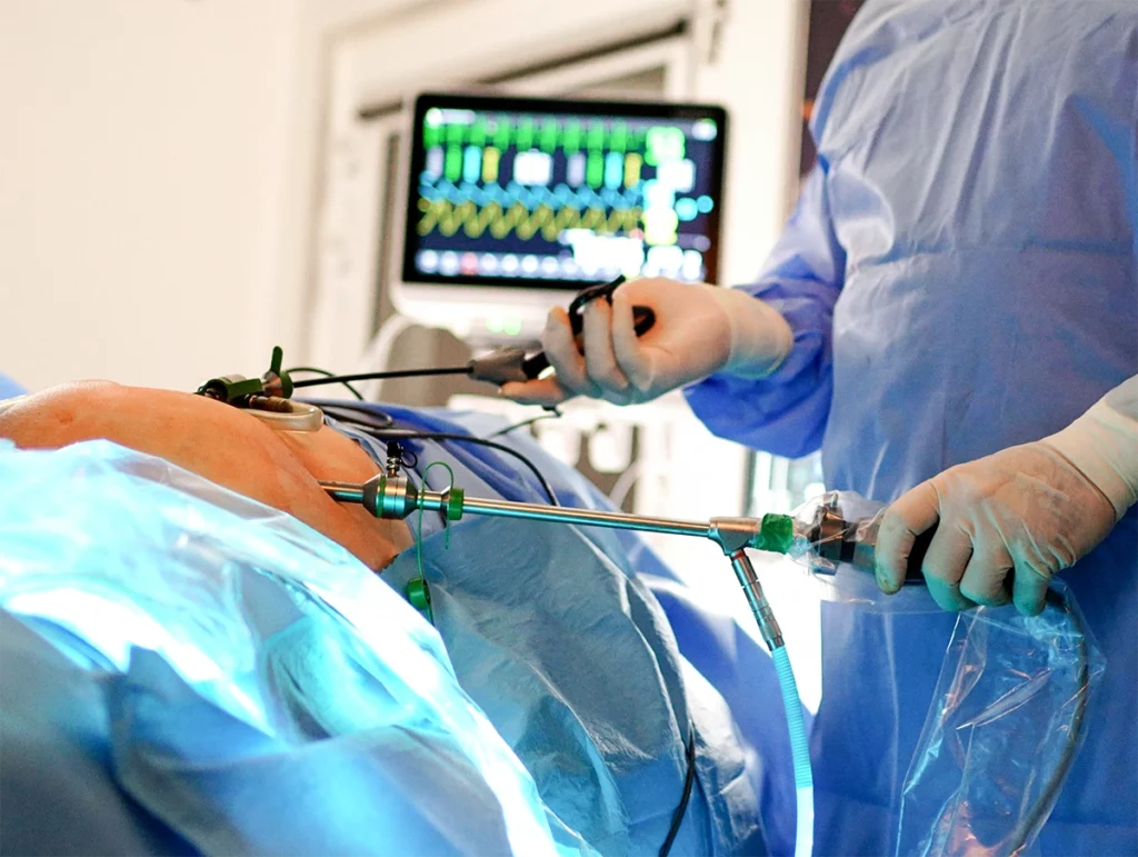 Przepuklina pachwinowa