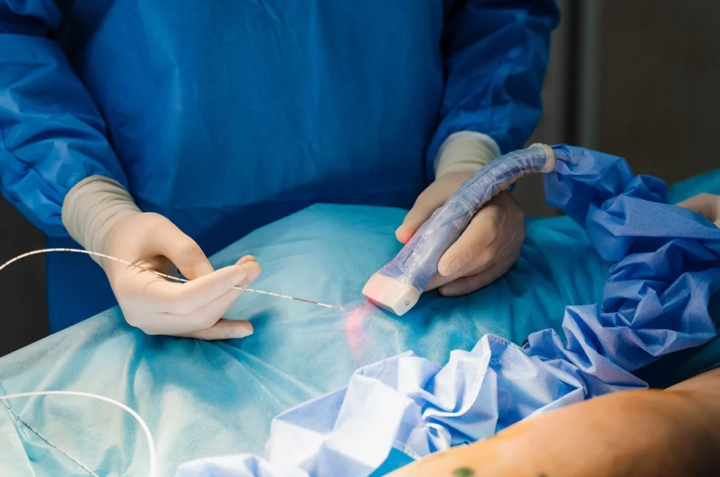 Małoinwazyjne metody operacji żylaków