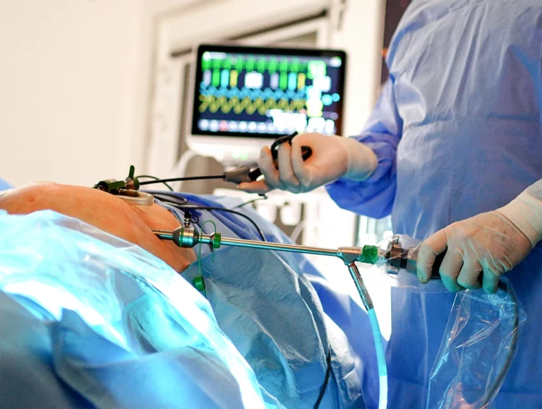 laparoskopia-Kamil-Bury